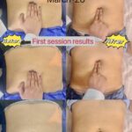 Top 10 Postpartum Recovery Centers in the Philippines 2026 (Research & Field Test Edition | A Must-Read for Expectant Mothers)