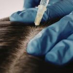 Advanced Scalp Treatment Offers New Hope for Hair Loss Solutions in the Philippines